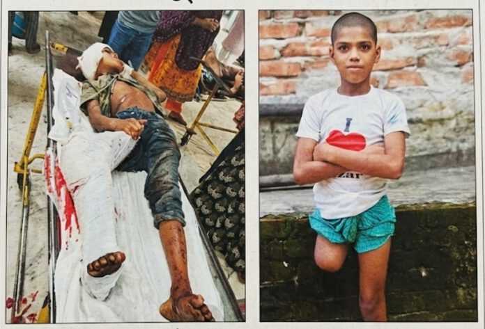 ডান পা কাটা ১২ বছরের শিশু মো. রায়হানকে নিয়ে বেরিয়ে আসলো চাঞ্চল্যকর তথ্য